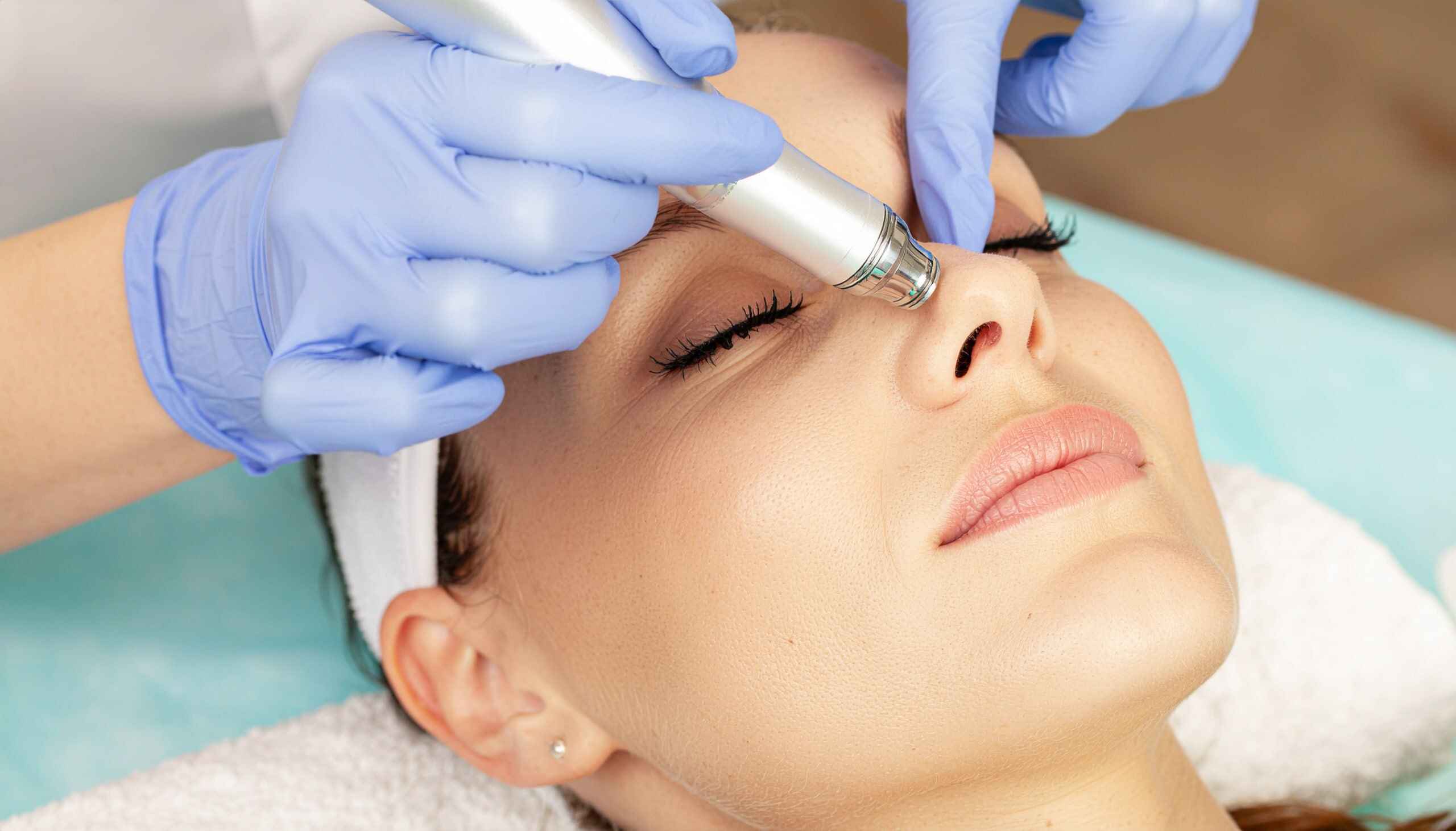 Radiance Renew – Medical HydraFacial + Microneedling 2