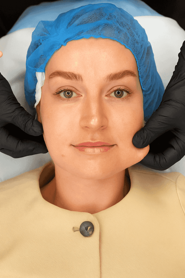 Endolift Premium Facial Lift 5