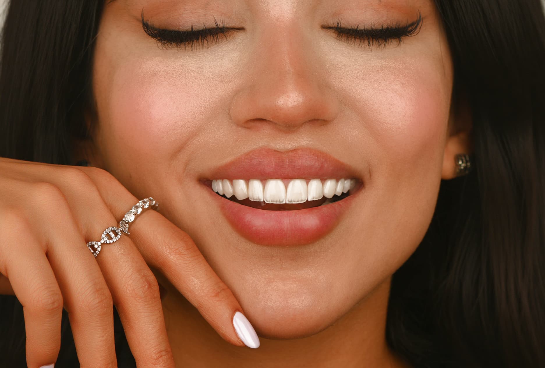 Complete Veneer Transformation Package